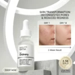 The Ordinary Niacinamide Serum (30 ml)